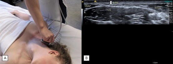 Estabilizadores escapula tempo formacion ecografia 4.jpg
